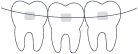 Ортодонтия